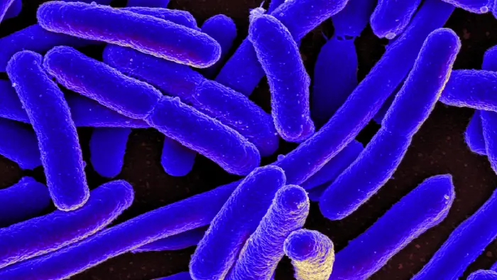 escherichia-coli-vi-khuan-trong-nha-tam
