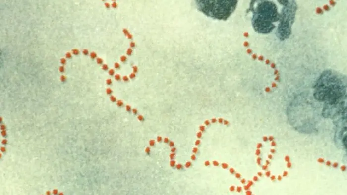 streptococcus-vi-khuan-trong-nha-tam